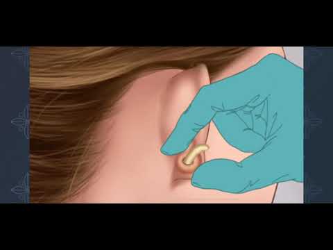Ear Care Satisfying Treatment ASMR #satisfying #makeup #asmr #youtube #youtubeshorts