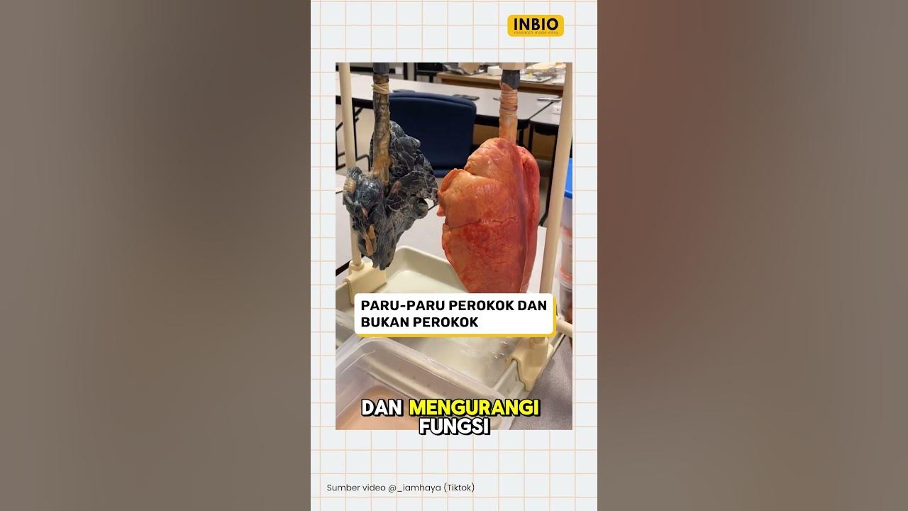 Paru paru perokok vs bukan perokok