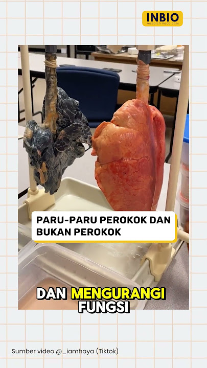Paru paru perokok vs bukan perokok