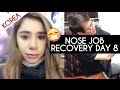 NOSE JOB PLASTIC SURGERY IN KOREA VLOG DAY 8 RECOVERY