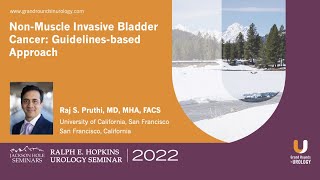 Non-Muscle Invasive Bladder Cancer: Guidelines-Based Approach