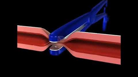 KLS MARTIN   marClamp®