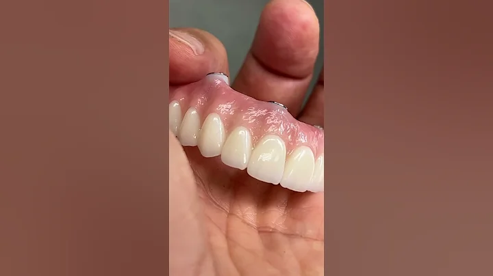 Great All-On-4 Zirconia