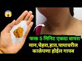        20    kitchen tips  home remedies  takau pasun