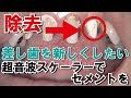 差し歯を新しくするための歯と歯茎の治療!! Treatment Of Teeth And Gums To Renew Post Crown