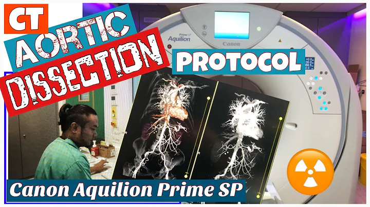 CT AORTOGRAM|Aortic Dissection Protocol|Canon Aquilion Prime SP