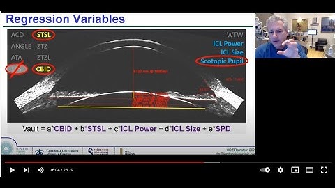 Improved ICL Sizing by direct posterior chamber measurements versus indirect white-to-white or OCT