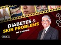 Diabetes and skin problems  dr v mohan