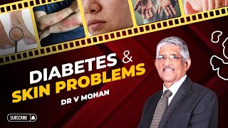 Diabetes and Skin Problems | Dr V Mohan