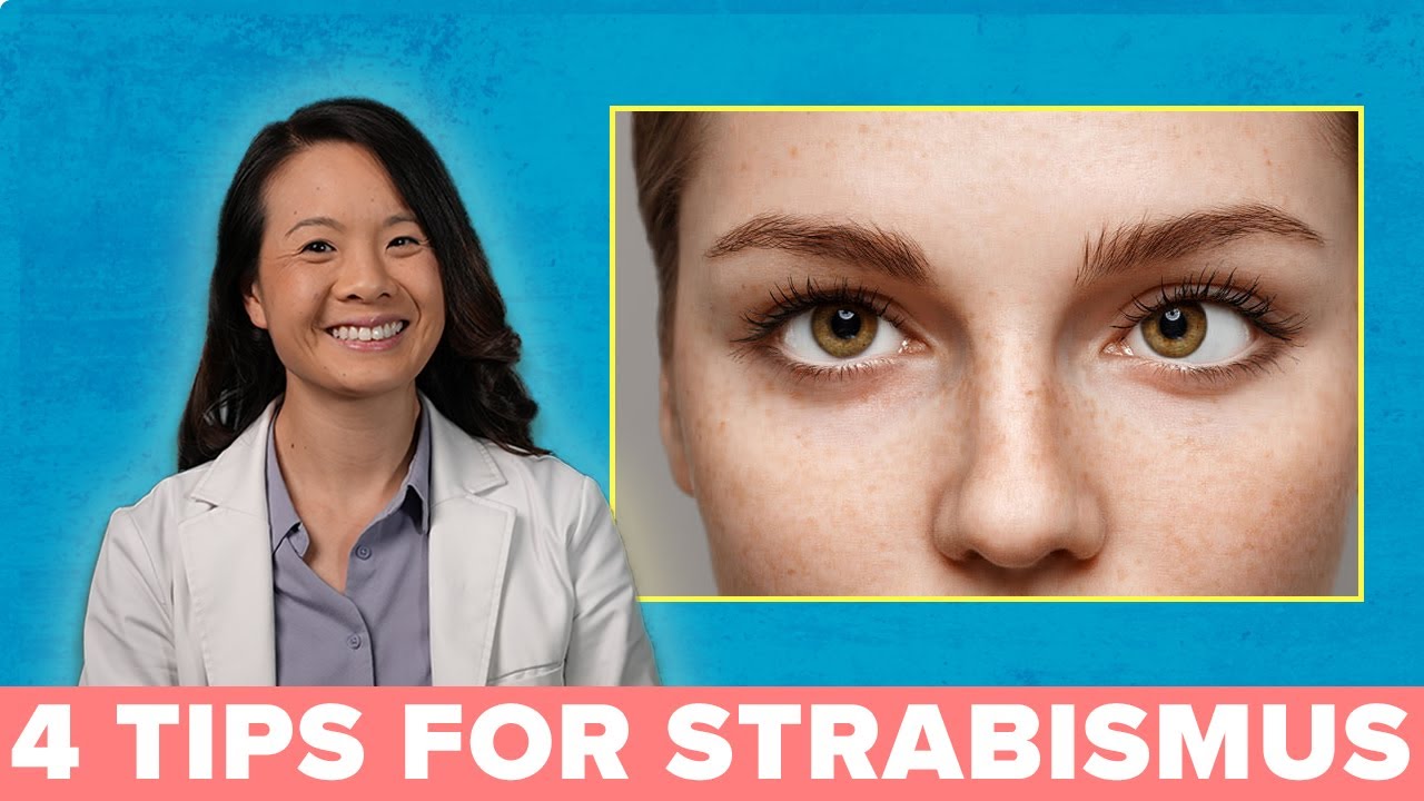 Strabismus (Crossed Eyes) - All About Vision