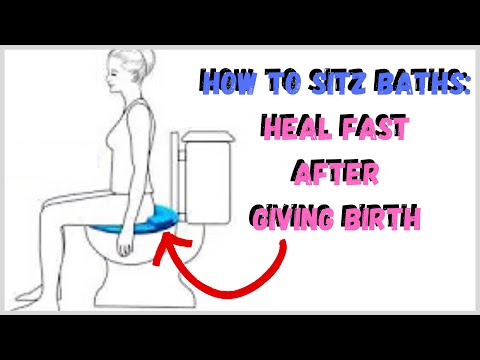 Video: Sitz Bath Postpartum: Vad Du Vill Veta Efter Att Du Födde