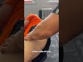 Post hip replacement pain relief of back and hamstring soreness