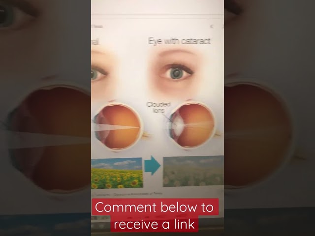 #1 eye therapy supplements for better eyesight! #shorts