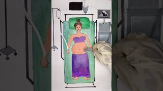 cesarean delivery #shorts #newbornbaby #maa #youtubeshorts #love #doctor #delivery #trend #trending