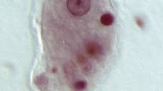 Entamoebida | Wikipedia audio article