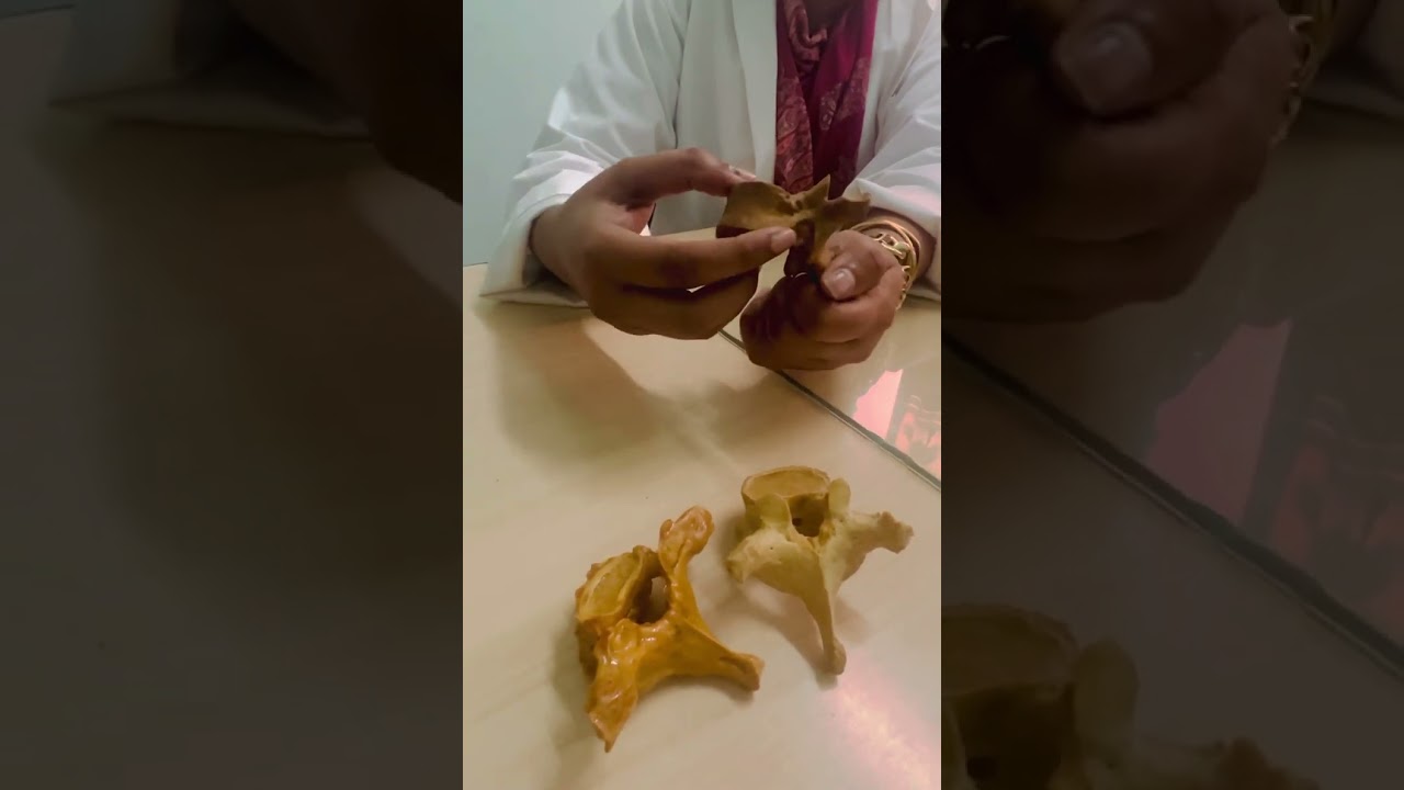 Thoracic vertebrae : easy identification in less than 5 minutes : typical and atypical vertebrae