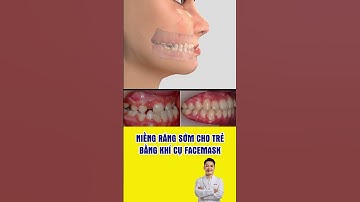 Niềng răng sớm cho trẻ bằng khí cụ Facemask #nhakhoa #bacsidieutaithu #niengrang