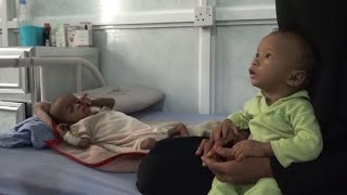 Millions Of Children Threatened By Famine In Yemen Charity