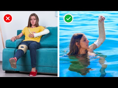 13 Lifehacks om met Gips om te Gaan / Hoe Overleef Je Gips in de Zomer