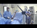 Shoulder Arthroscopy Surgery