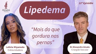 Lipedema - Mais do que gordura nas pernas