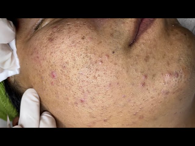 Satisfying video with Chung Vo Spa | 205