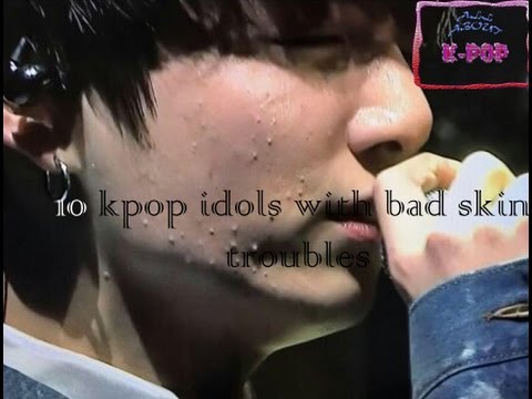 Kpop Idols With Bad Skin Random Onehallyu