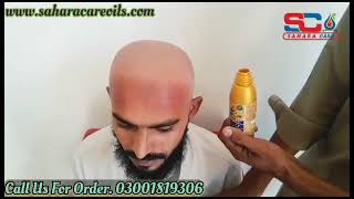 Sahara Care Regrowth Hair Oil - Hair loss Treatment Oil - Herbal Hair Regrowth oil  03001819306