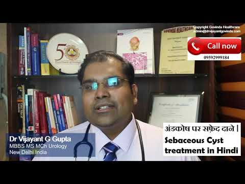 अंडकोष पर फोड़े फुंसी | अंडकोष के बालतोड़ | Sebaceous Cyst Scrotum treatment in Hindi