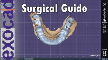 Simple Exocad Surgical Guide
