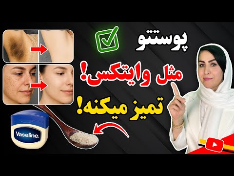 خداحافظی با لکه های پوستی و تیرگی های بدن یکبار برای همیشه با ابن ترکیب پوستتو برق بنداز