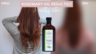 3 Months Of Using VIRAL TIKTOK Rosemary Hair Oil...It Didn't Go Quite To Plan!