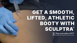 Sculptra Butt Lift: Fill Hip Dips and Get a Beautiful, Natural Butt Lift