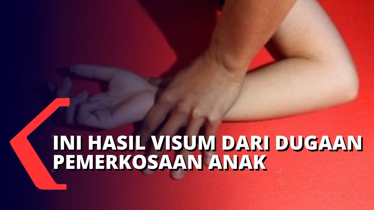 Dugaan Pemerkosaan 3 Anak, Polisi: Hasil Visum Tidak Ada Tanda Kekerasan Seksual