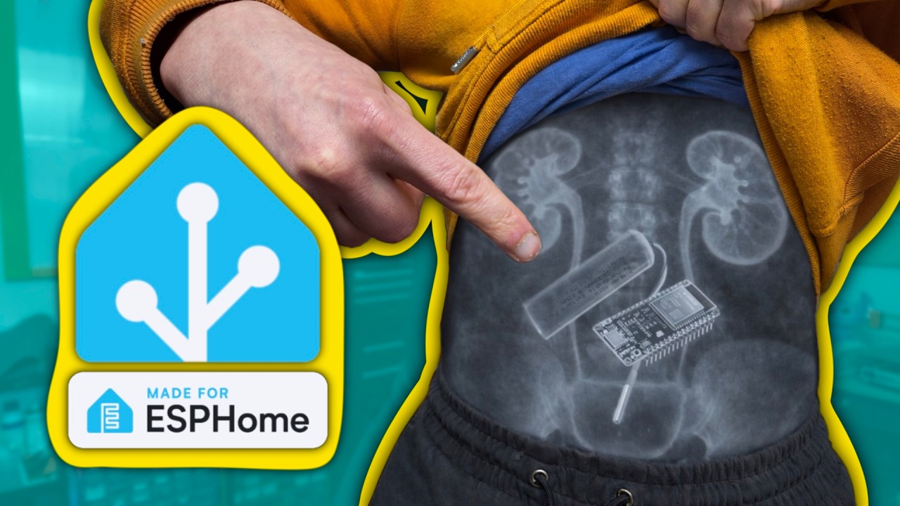 I Gave My Bladder a Home Assistant Integration