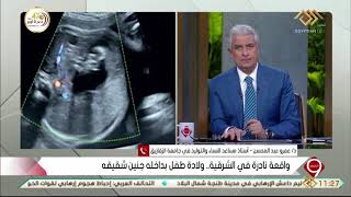 التاسعة | د/ عمرو عبد المحسن  يفسر واقعة نادرة في الشرقية   ولادة طفل بداخله جنين شقيقه