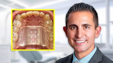 FME Piloting Explained | Dr. Jeremy Manuele