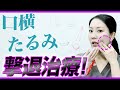 【タイプ別】口横のたるみ治療について徹底解説します。