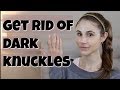 GET RID OF DARK KNUCKLES| DR DRAY