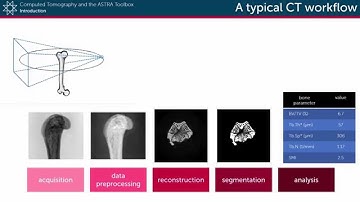 A typical CT workflow