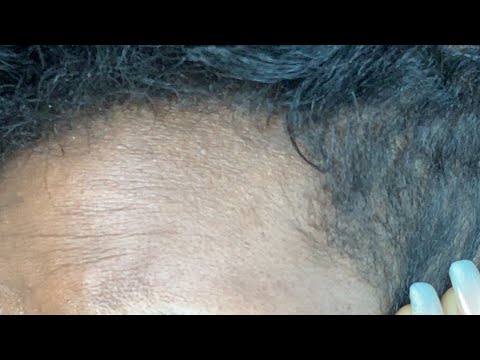 How to fix damaged hair| Why my hair won't grow - YouTube