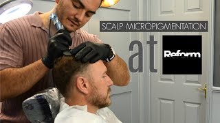 Scalp Micropermentation at Reform