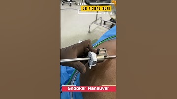 Da Vinci Robotic Surgery Camera Insertion Technique