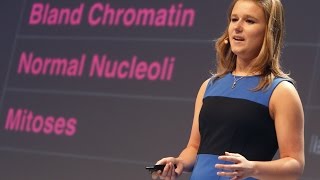 Decoding Cancer - Brittany Wenger '17 Profile
