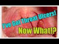 I've Been Told I Have Throat Ulcers! Now What?