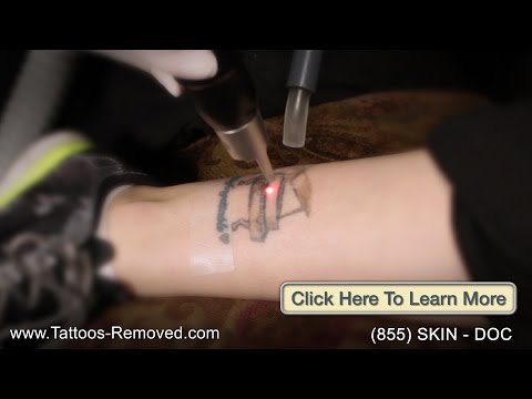 tattoo-removal-nassau-county-li-|-laser-tattoo-removal-long-island-ny-|-dr.-westfried