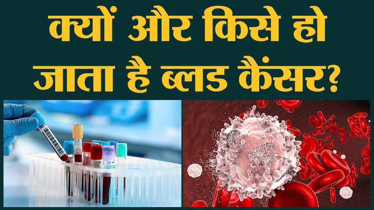 Blood Cancer के शुरुआती लक्षण जानें, जो आपकी जान बचा सकते हैं | Sehat ep 235