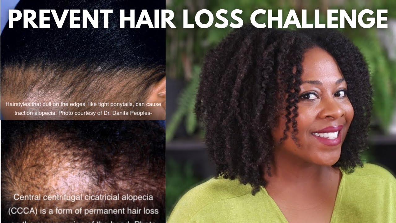 5 Best Thinning Hair Solutions for Women with Alopecia in 2024