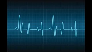 Live Heartbeat Steam