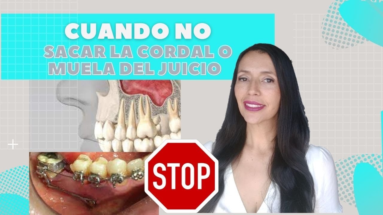 Que hacer si me duele la muela del juicio